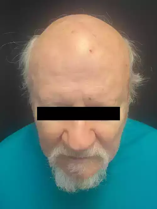 Dr. Eduardo_casos reais_008a