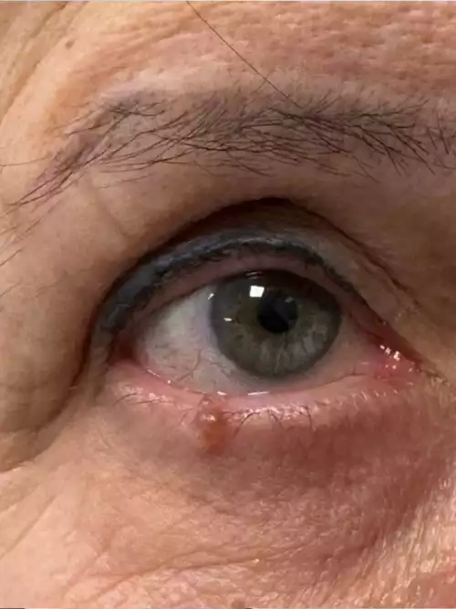 Dr. Eduardo_casos reais_013