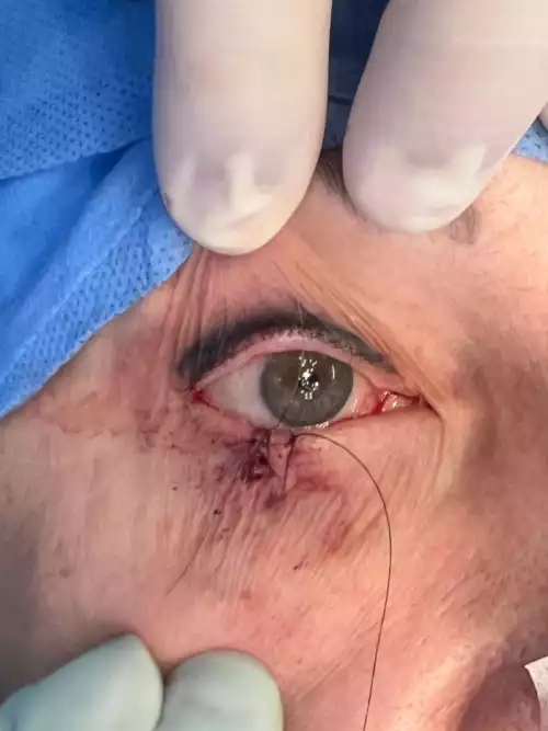 Dr. Eduardo_casos reais_017