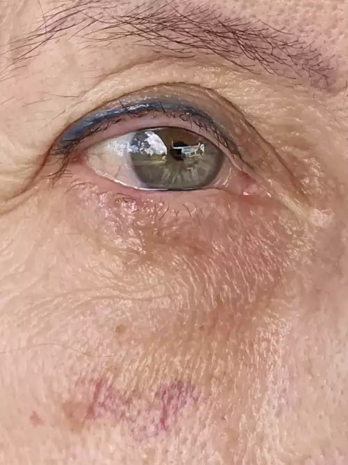 Dr. Eduardo_casos reais_018