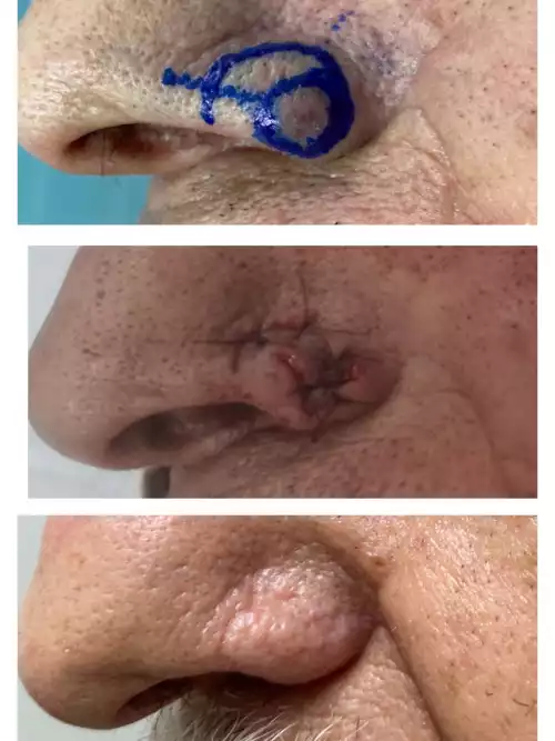 Dr. Eduardo_casos reais_021